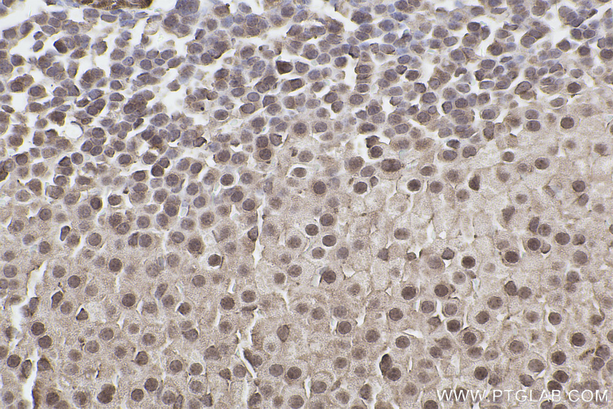Immunohistochemical analysis of paraffin-embedded mouse adrenal gland tissue slide using KHC2466 (PDCD11 IHC Kit).