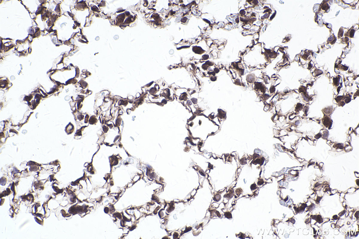 Immunohistochemical analysis of paraffin-embedded mouse lung tissue slide using KHC2466 (PDCD11 IHC Kit).