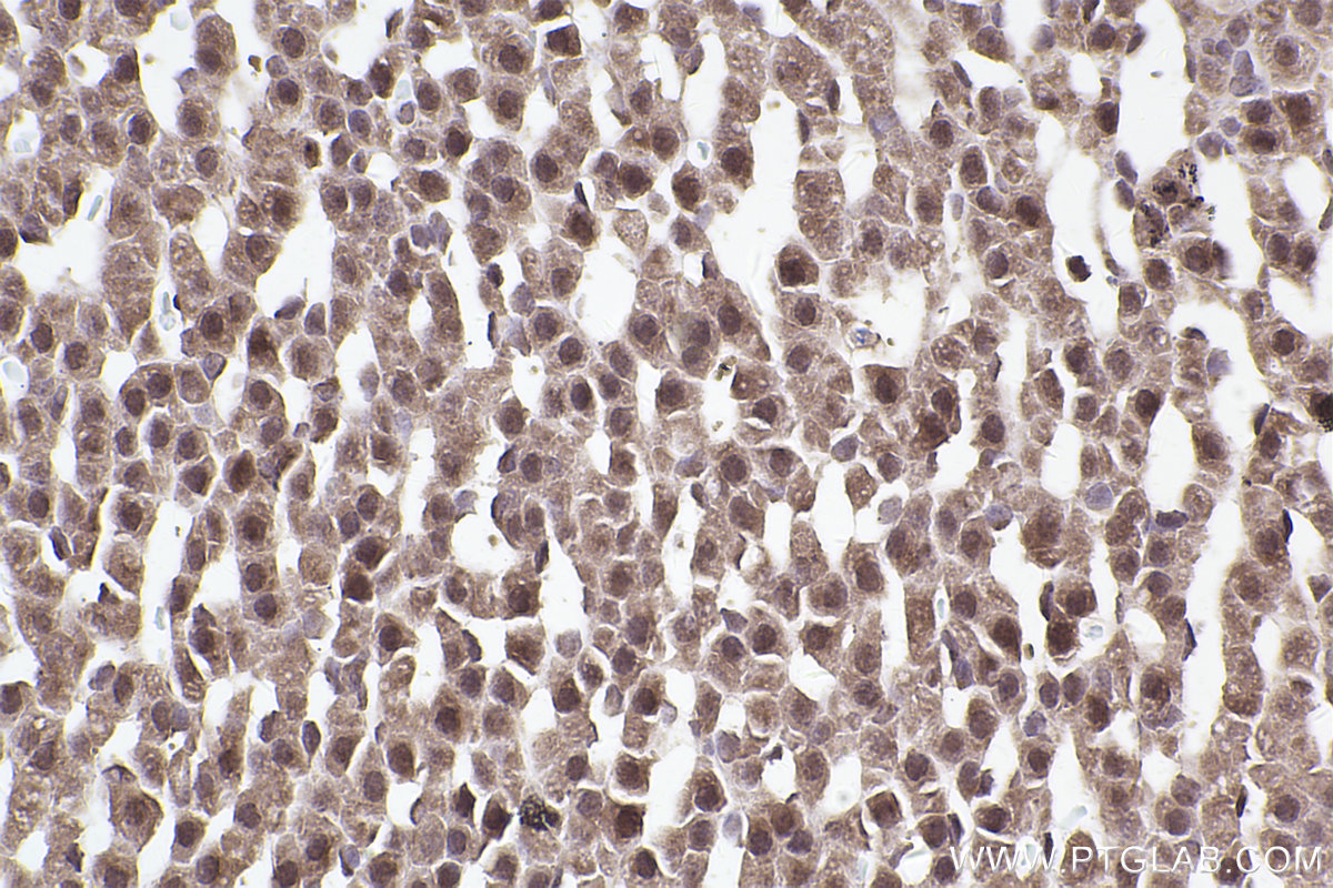 Immunohistochemical analysis of paraffin-embedded rat adrenal gland tissue slide using KHC2466 (PDCD11 IHC Kit).