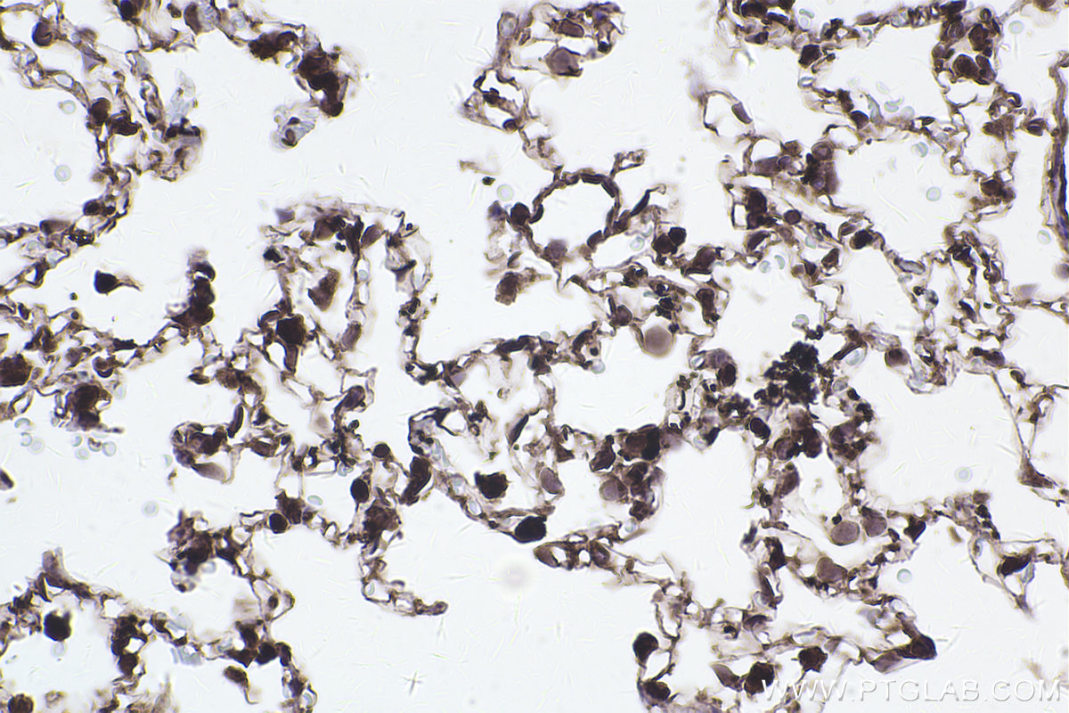 Immunohistochemical analysis of paraffin-embedded rat lung tissue slide using KHC2466 (PDCD11 IHC Kit).