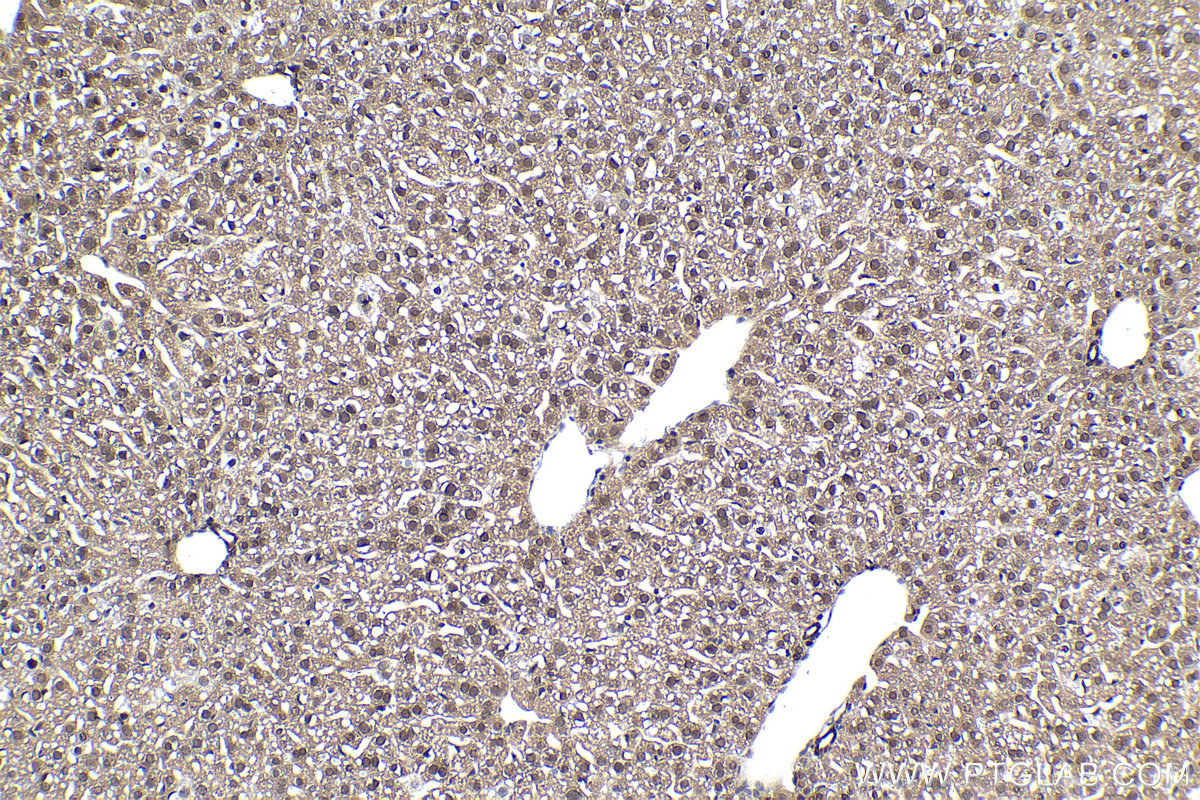 Immunohistochemical analysis of paraffin-embedded mouse liver tissue slide using KHC1048 (PDCD6 IHC Kit).