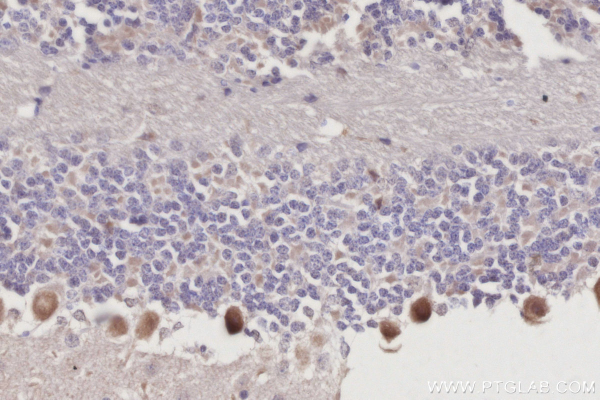 Immunohistochemical analysis of paraffin-embedded mouse cerebellum tissue slide using KHC3051 (PDE10A IHC Kit). Immunohistochemical analysis of paraffin-embedded mouse cerebellum tissue slide using KHC3051 (PDE10A IHC Kit).