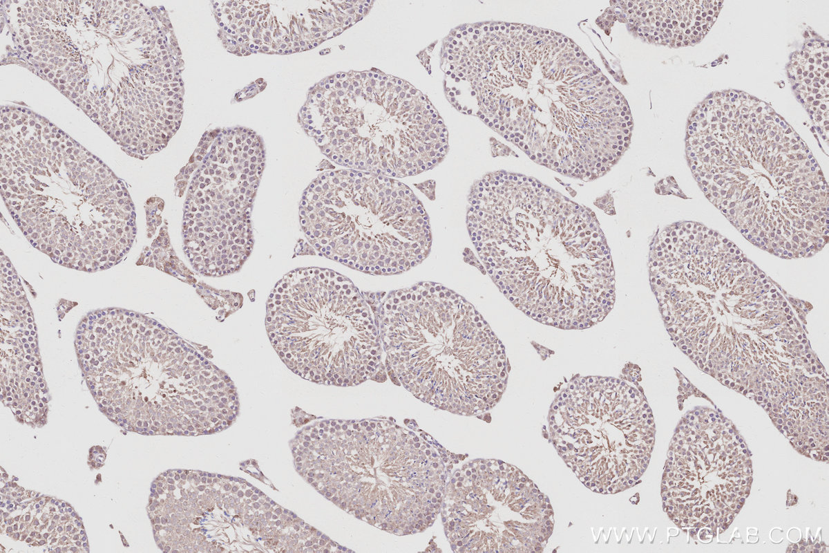Immunohistochemical analysis of paraffin-embedded mouse testis tissue slide using KHC3051 (PDE10A IHC Kit). Immunohistochemical analysis of paraffin-embedded mouse testis tissue slide using KHC3051 (PDE10A IHC Kit).