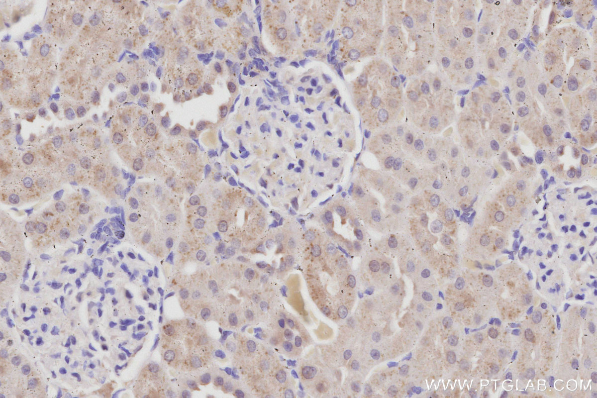 Immunohistochemical analysis of paraffin-embedded rat kidney tissue slide using KHC3051 (PDE10A IHC Kit). Immunohistochemical analysis of paraffin-embedded rat kidney tissue slide using KHC3051 (PDE10A IHC Kit).