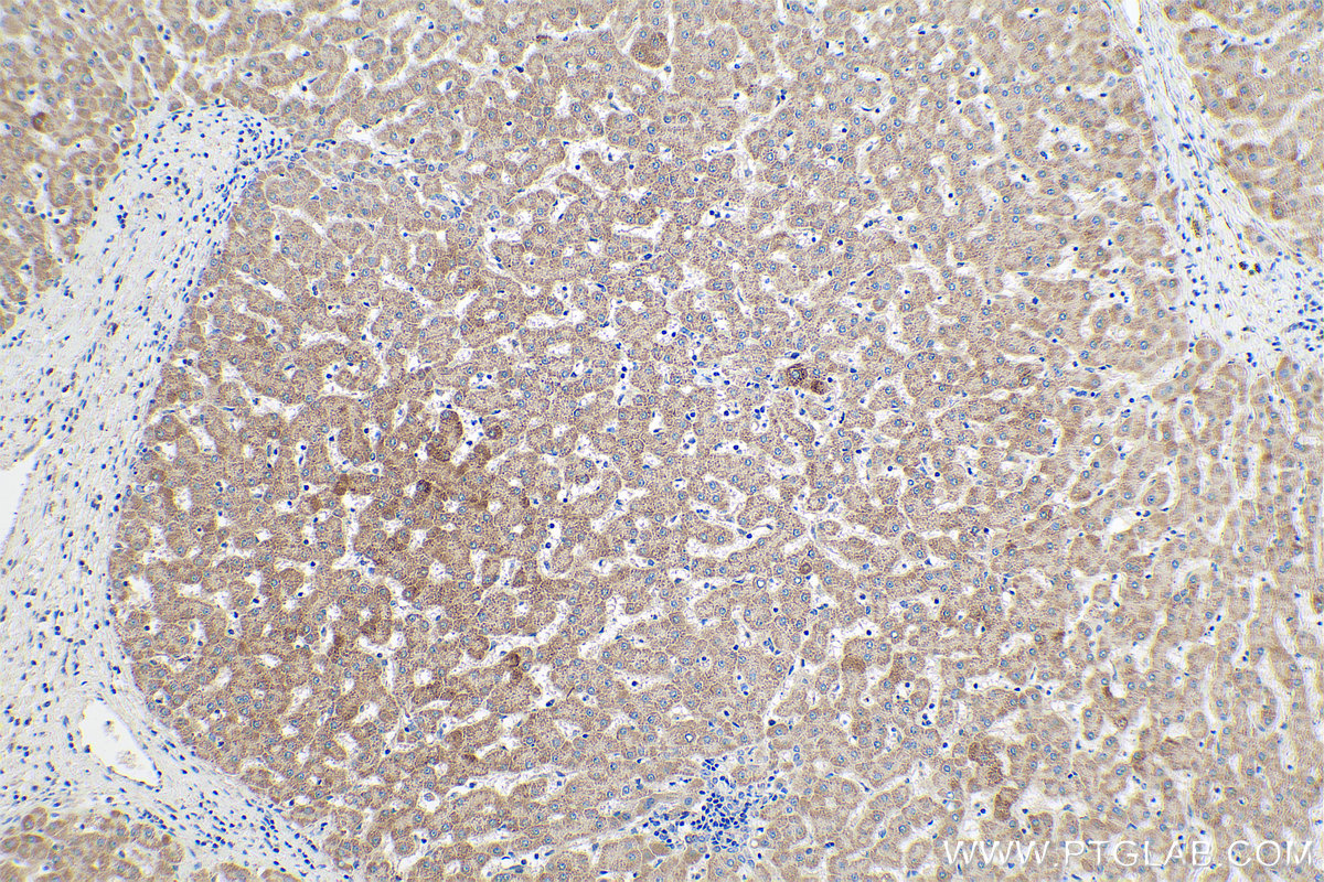 Immunohistochemical analysis of paraffin-embedded human liver tissue slide using KHC0817 (PDGFRL IHC Kit).