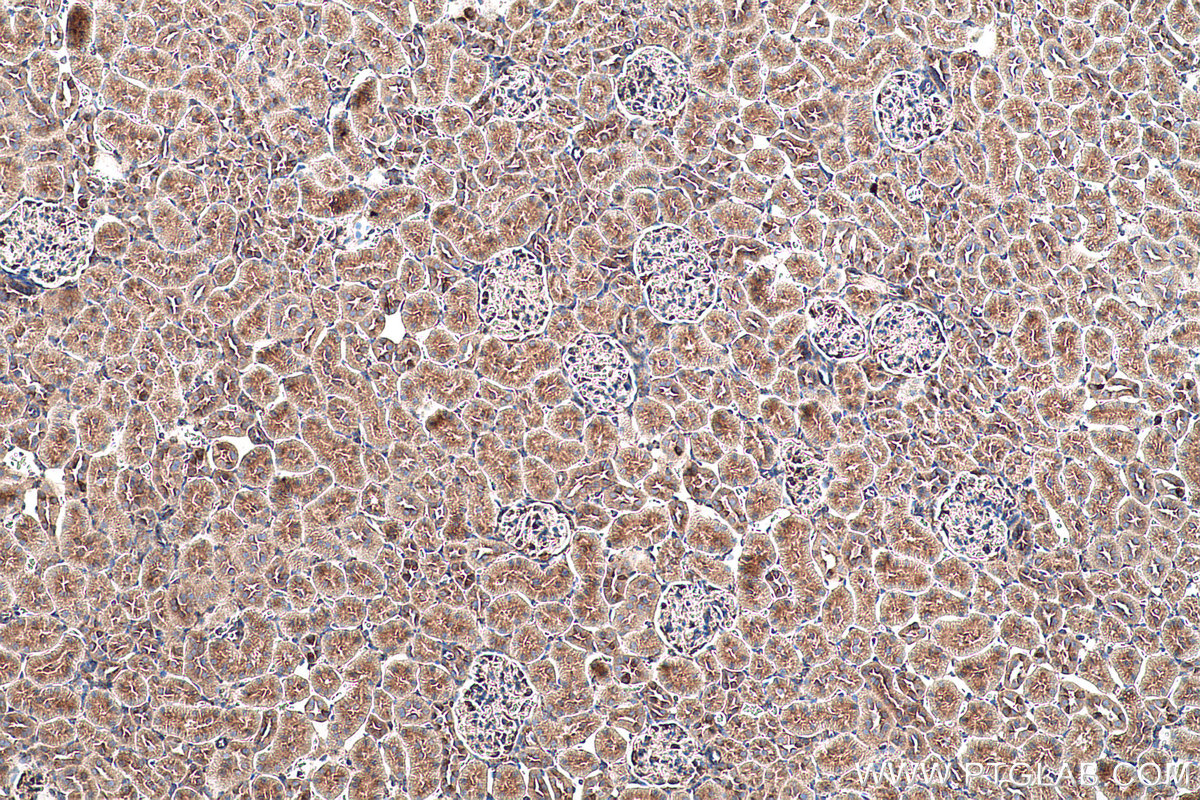 Immunohistochemical analysis of paraffin-embedded rat kidney tissue slide using KHC0584 (PDIA4/ERP72 IHC Kit).