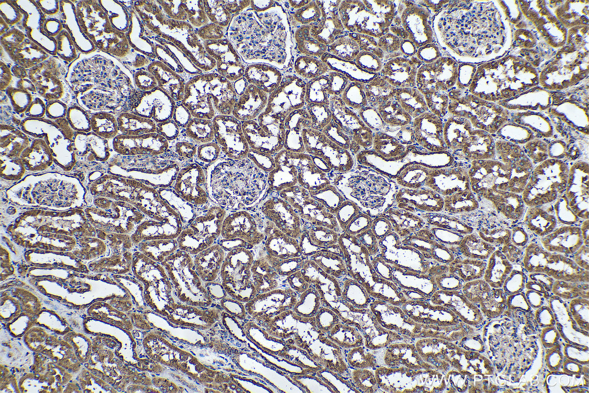 Immunohistochemical analysis of paraffin-embedded human kidney tissue slide using KHC0579 (PDIA6 IHC Kit).