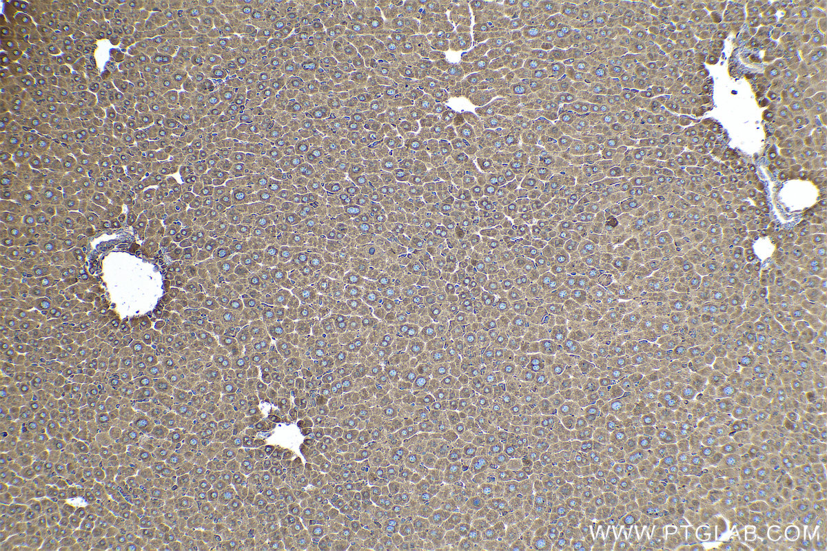 Immunohistochemical analysis of paraffin-embedded mouse liver tissue slide using KHC0579 (PDIA6 IHC Kit).