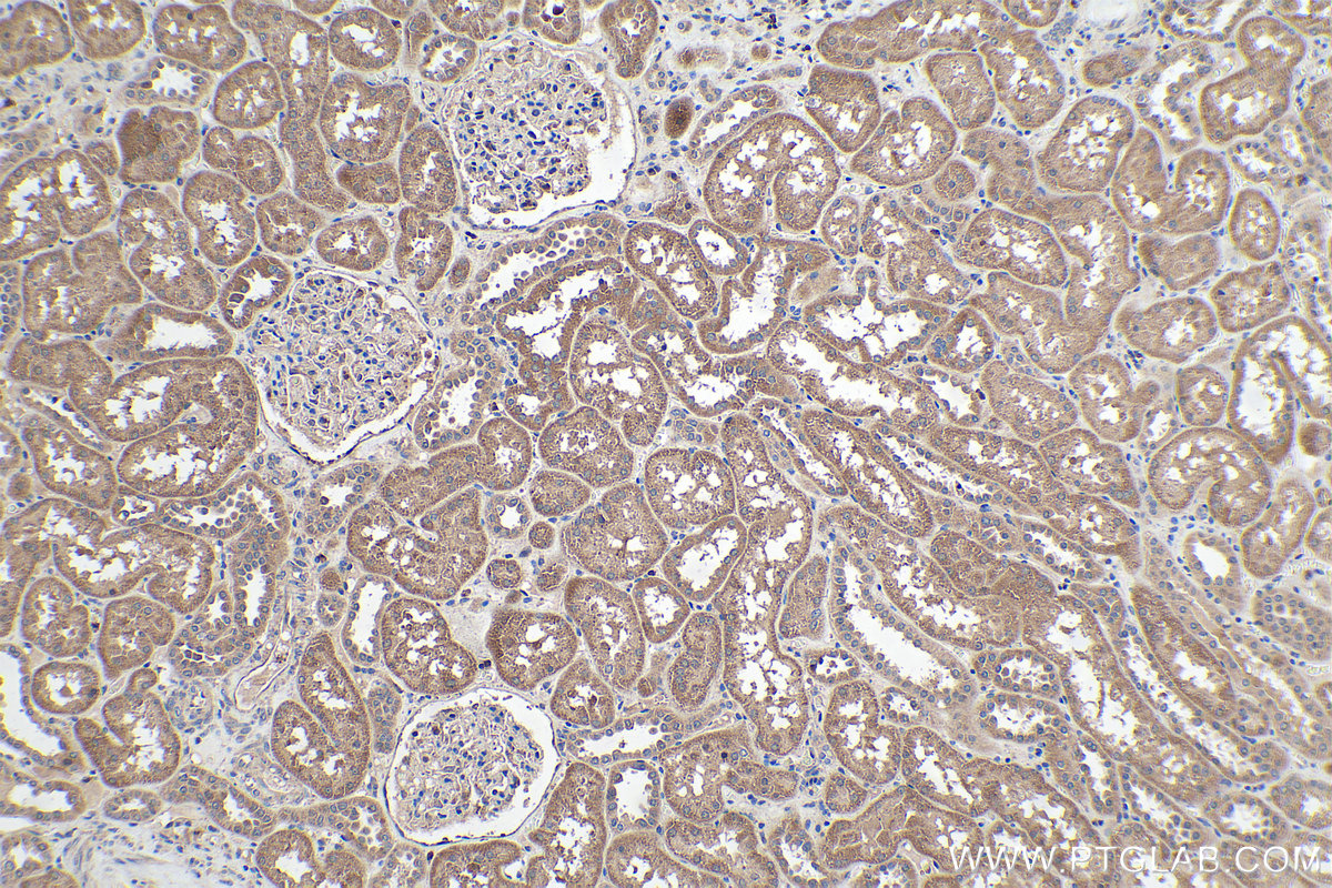 Immunohistochemical analysis of paraffin-embedded human kidney tissue slide using KHC0190 (PDK1 IHC Kit).