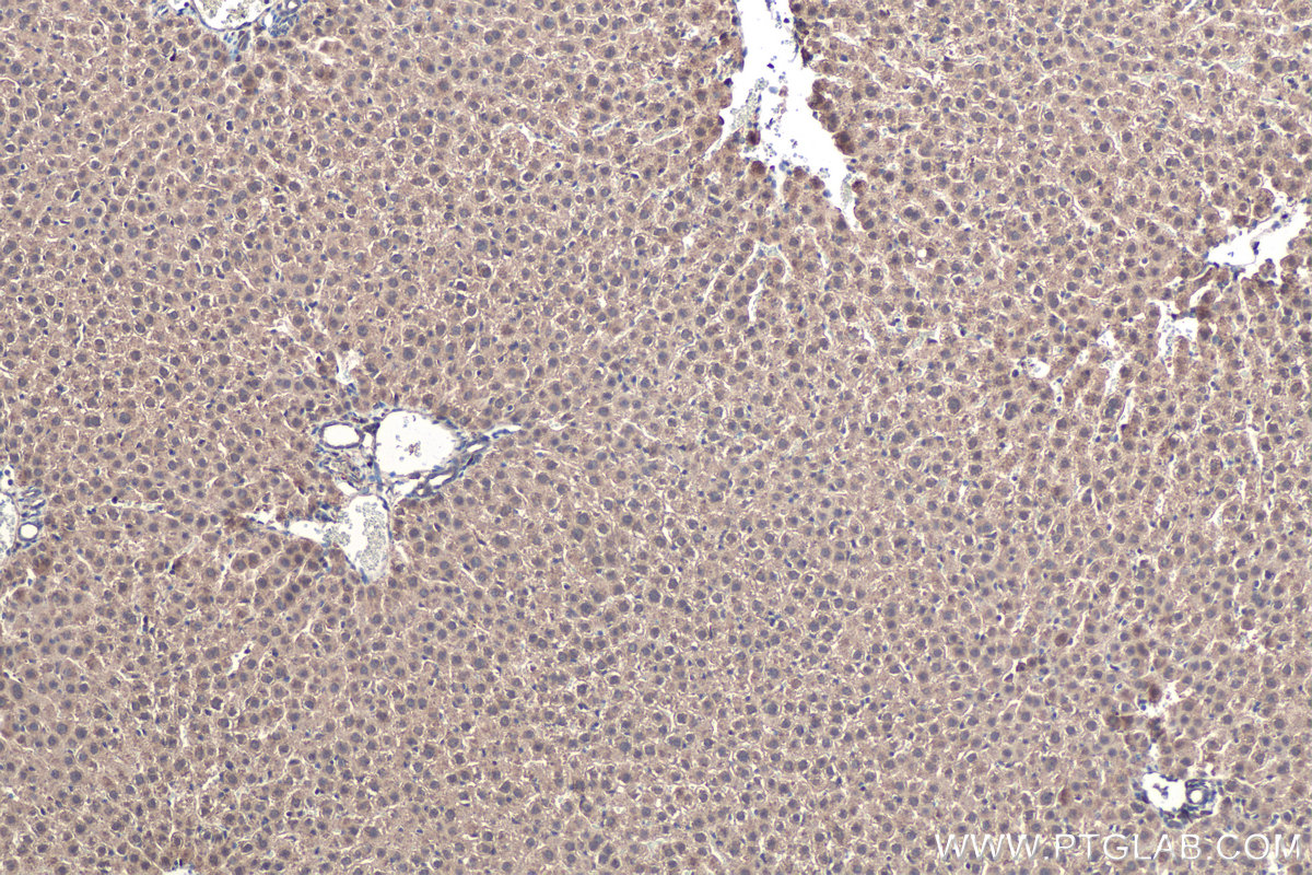 Immunohistochemical analysis of paraffin-embedded rat liver tissue slide using KHC0444 (PDLIM7 IHC Kit).