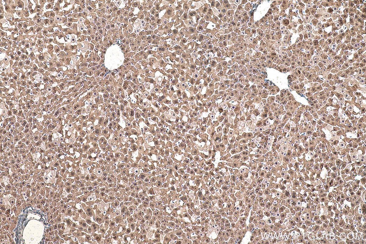 Immunohistochemical analysis of paraffin-embedded mouse liver tissue slide using KHC0864 (PDXK IHC Kit).