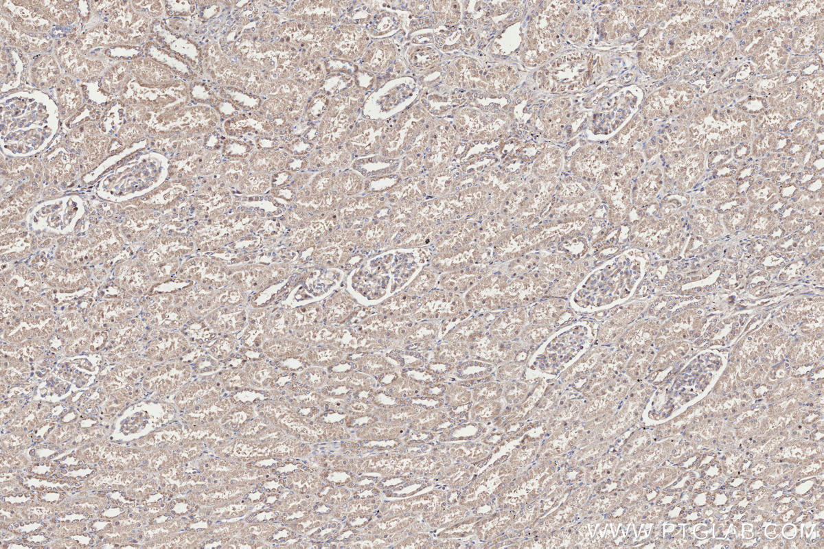 Immunohistochemical analysis of paraffin-embedded human kidney tissue slide using KHC3296 (PDZD8 IHC Kit).