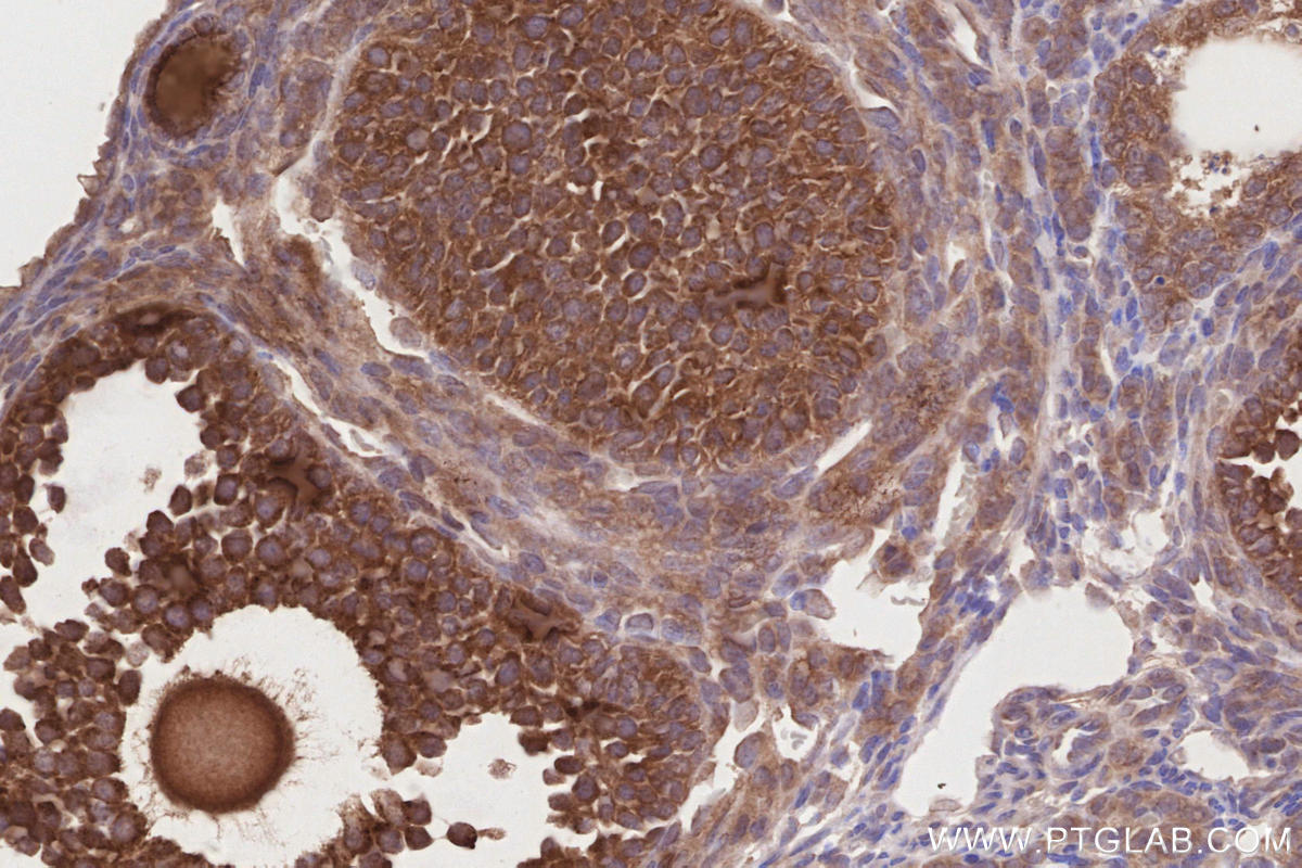 Immunohistochemical analysis of paraffin-embedded mouse ovary tissue slide using KHC2859 (PELO IHC Kit).