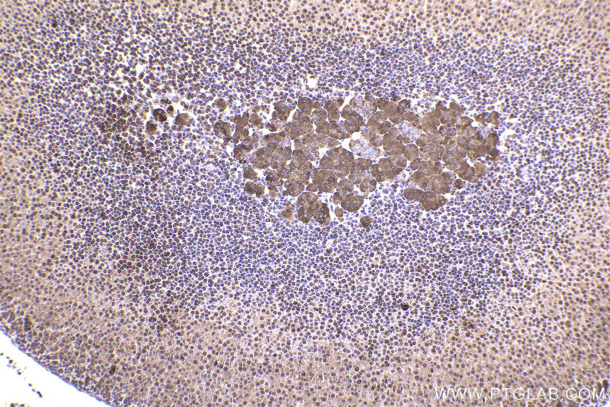 Immunohistochemical analysis of paraffin-embedded mouse adrenal gland tissue slide using KHC2331 (PER3 IHC Kit).