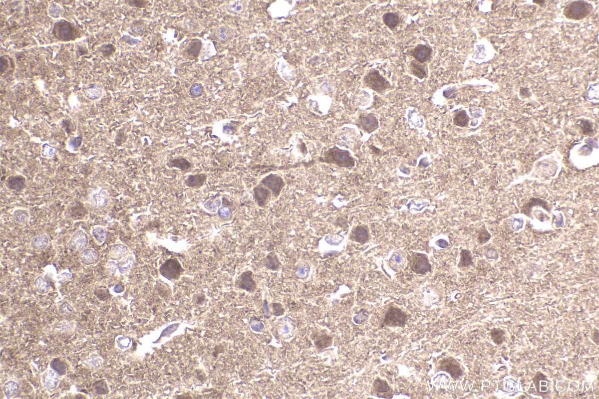 Immunohistochemical analysis of paraffin-embedded mouse brain tissue slide using KHC2331 (PER3 IHC Kit).