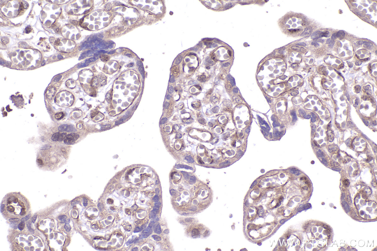Immunohistochemical analysis of paraffin-embedded human placenta tissue slide using KHC2349 (PEX5 IHC Kit).