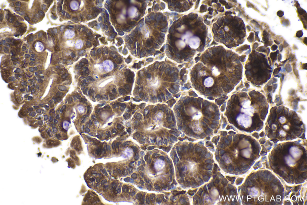 Immunohistochemical analysis of paraffin-embedded mouse intestine tissue slide using KHC1959 (PFDN4 IHC Kit).