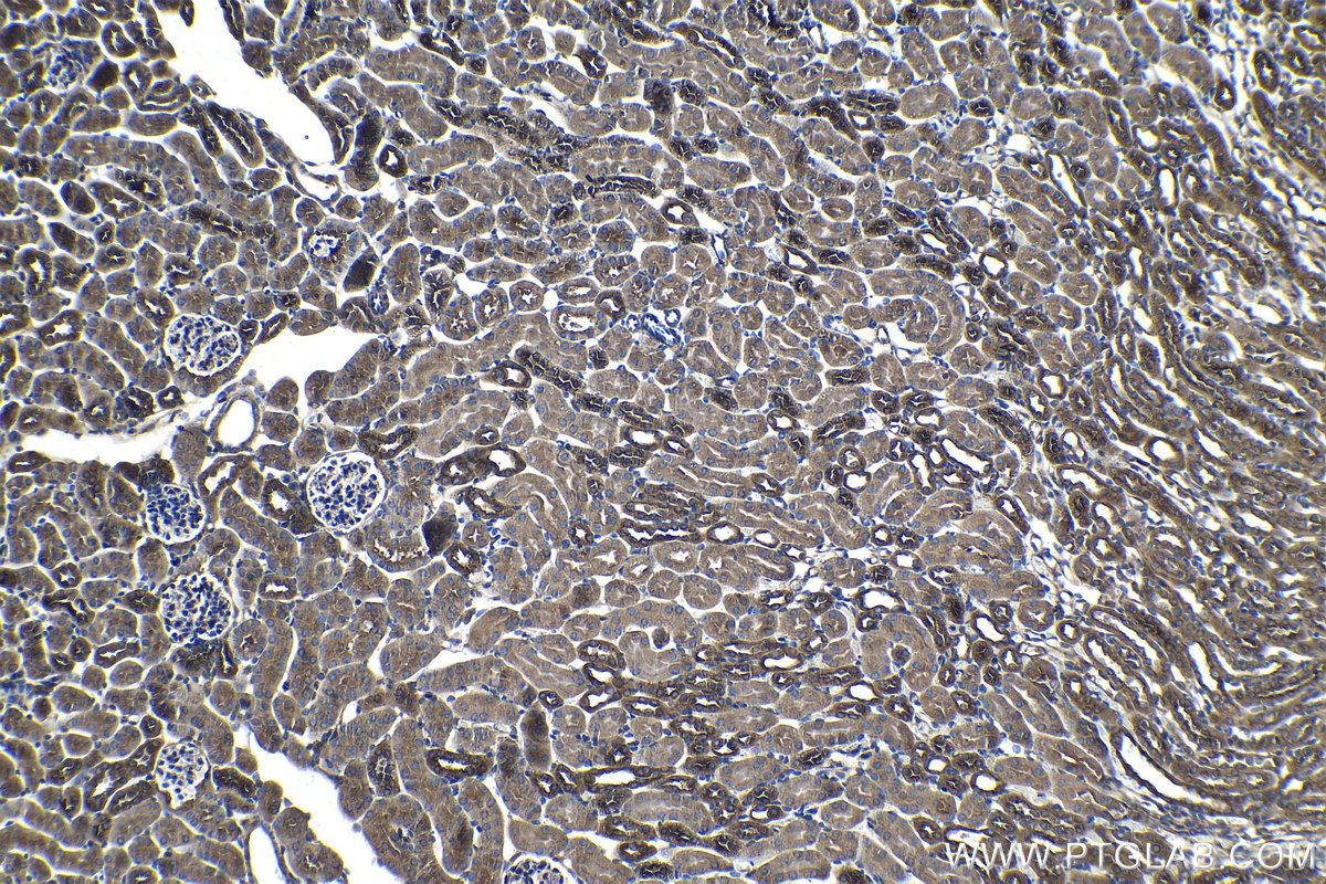 Immunohistochemical analysis of paraffin-embedded mouse kidney tissue slide using KHC1278 (PFKL IHC Kit).