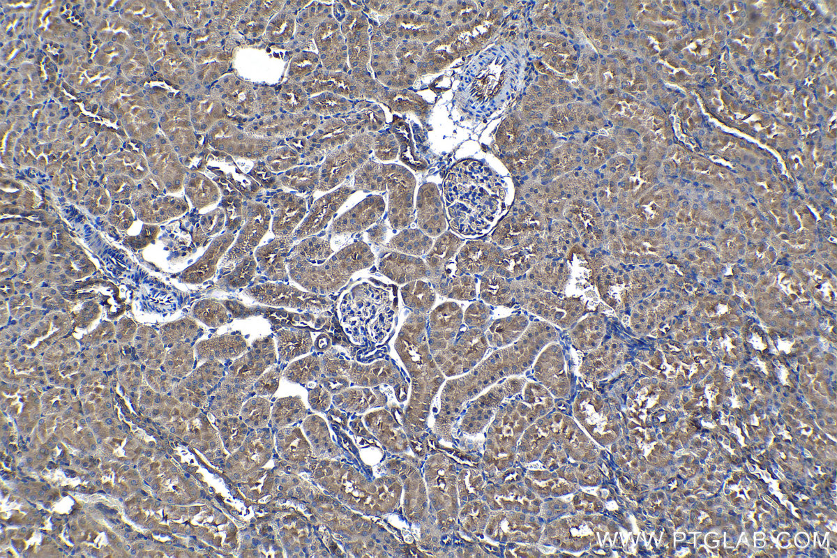 Immunohistochemical analysis of paraffin-embedded rat kidney tissue slide using KHC1278 (PFKL IHC Kit).