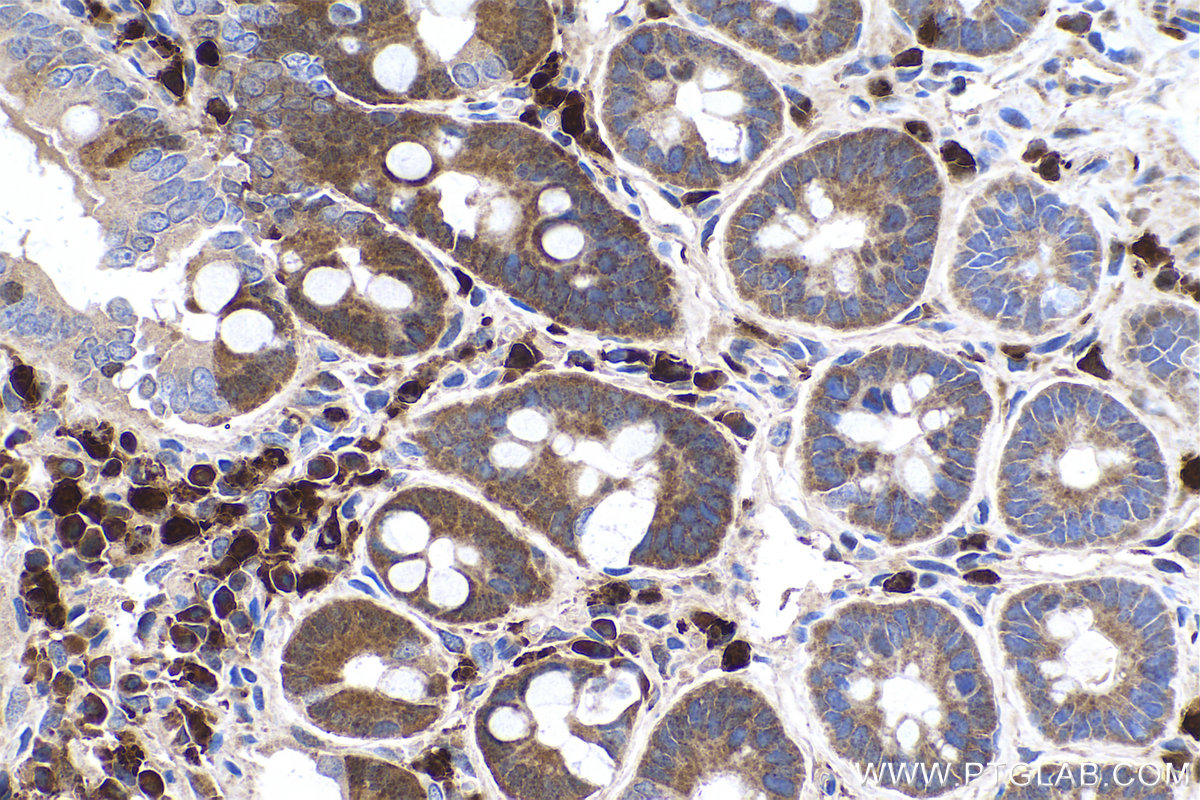 Immunohistochemical analysis of paraffin-embedded rat small intestine tissue slide using KHC0519 (PFN1 IHC Kit).