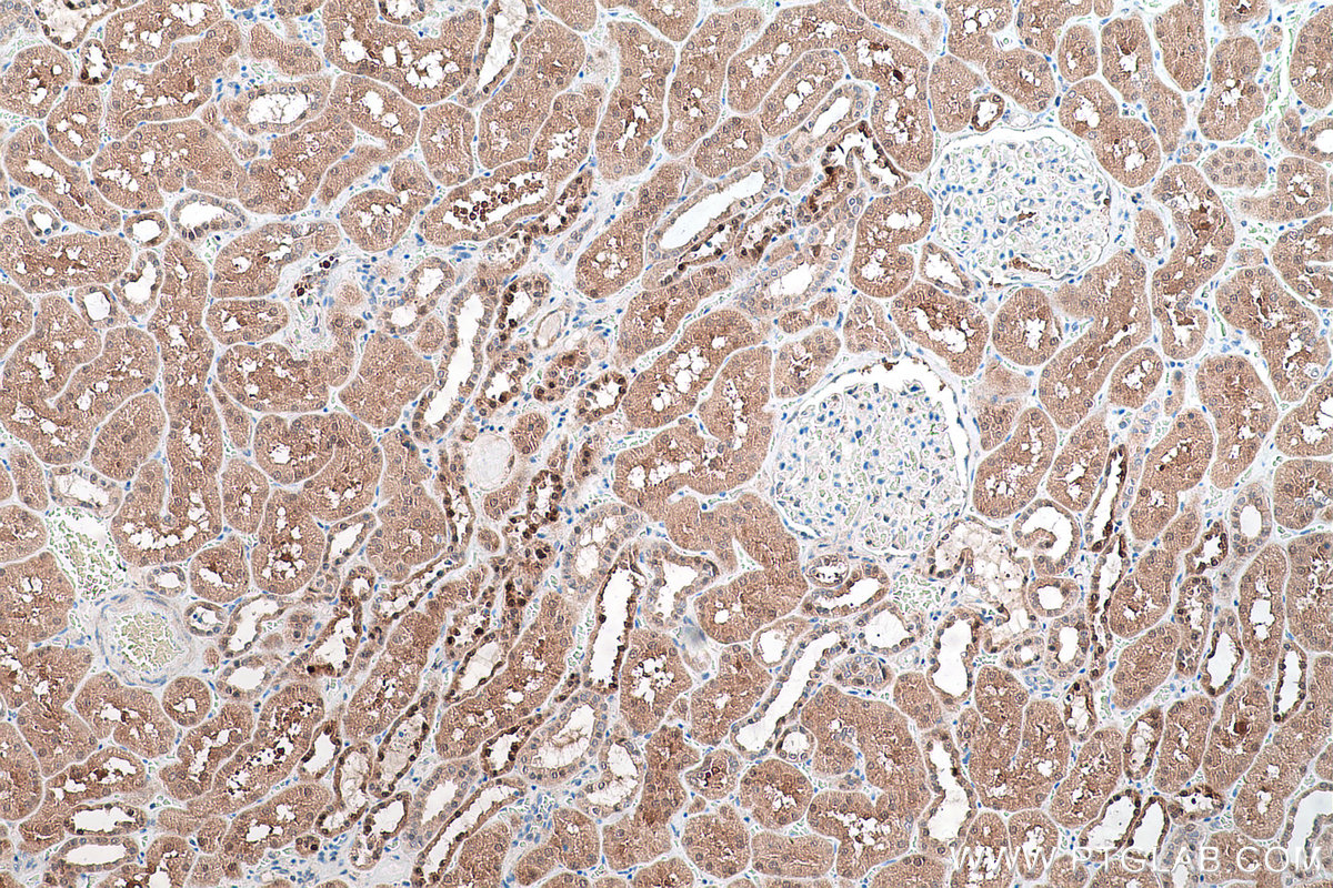 Immunohistochemical analysis of paraffin-embedded human kidney tissue slide using KHC0567 (PGM1 IHC Kit).