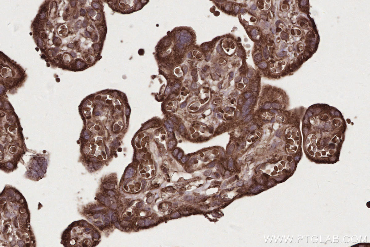Immunohistochemical analysis of paraffin-embedded human placenta tissue slide using KHC2662 (PHACTR4 IHC Kit).