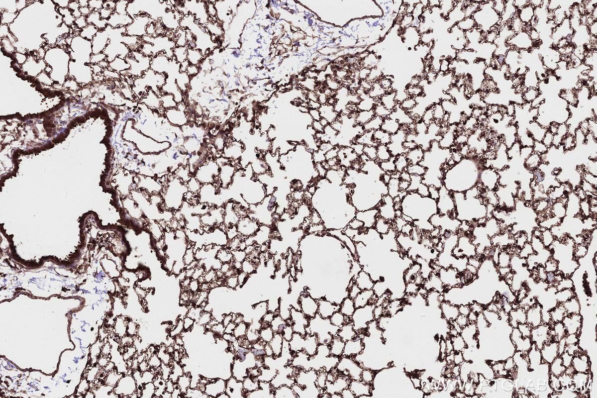 Immunohistochemical analysis of paraffin-embedded mouse lung tissue slide using KHC2662 (PHACTR4 IHC Kit).