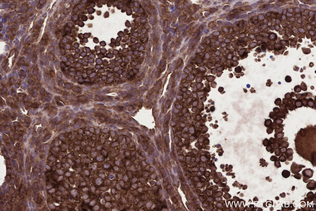 Immunohistochemical analysis of paraffin-embedded mouse ovary tissue slide using KHC2662 (PHACTR4 IHC Kit).