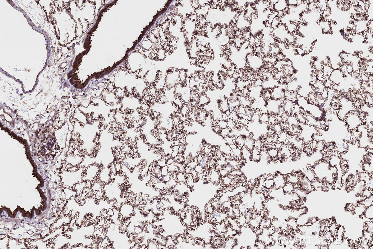 Immunohistochemical analysis of paraffin-embedded rat lung tissue slide using KHC2662 (PHACTR4 IHC Kit).