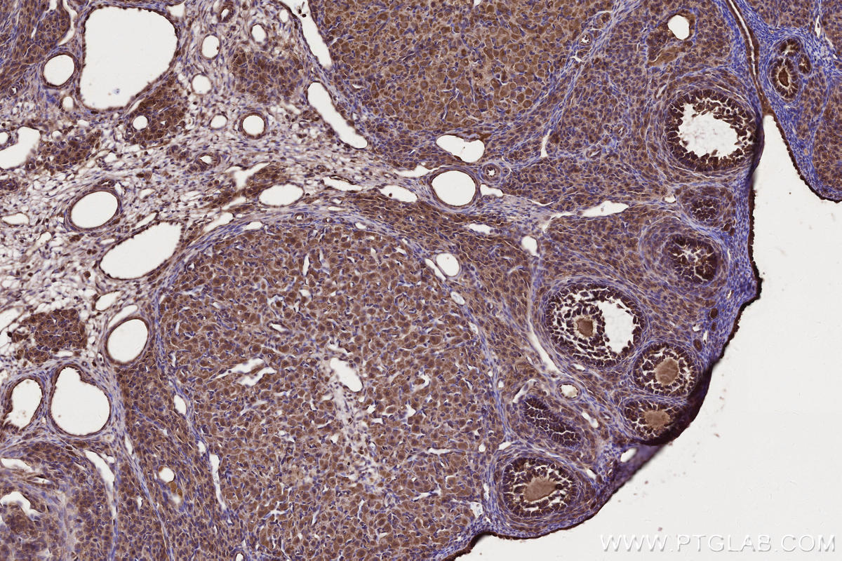Immunohistochemical analysis of paraffin-embedded rat ovary tissue slide using KHC2662 (PHACTR4 IHC Kit).