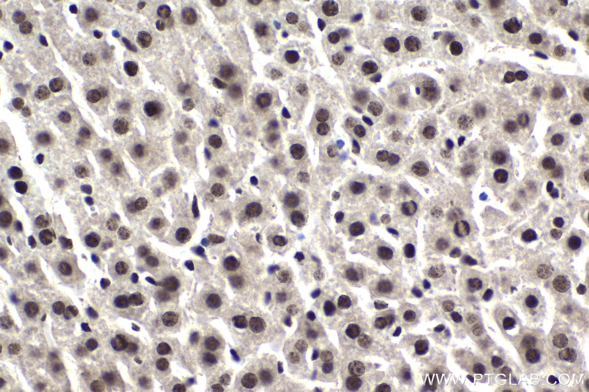 Immunohistochemical analysis of paraffin-embedded mouse liver tissue slide using KHC1822 (PHC2 IHC Kit).