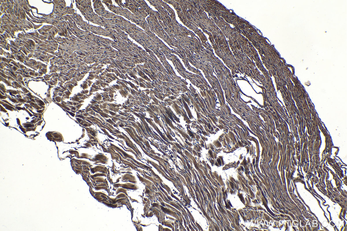 Immunohistochemical analysis of paraffin-embedded mouse heart tissue slide using KHC1225 (PHD2/EGLN1 IHC Kit).