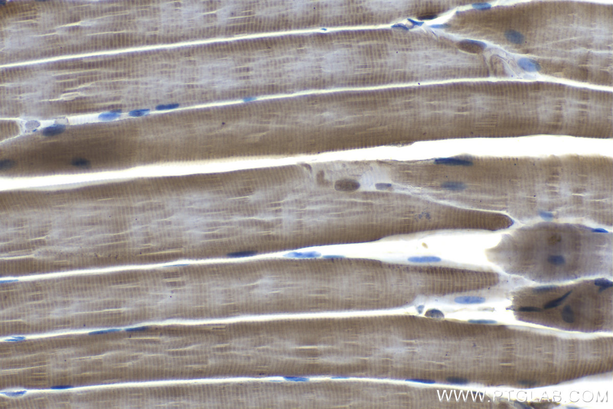 Immunohistochemical analysis of paraffin-embedded rat skeletal muscle tissue slide using KHC1225 (PHD2/EGLN1 IHC Kit).