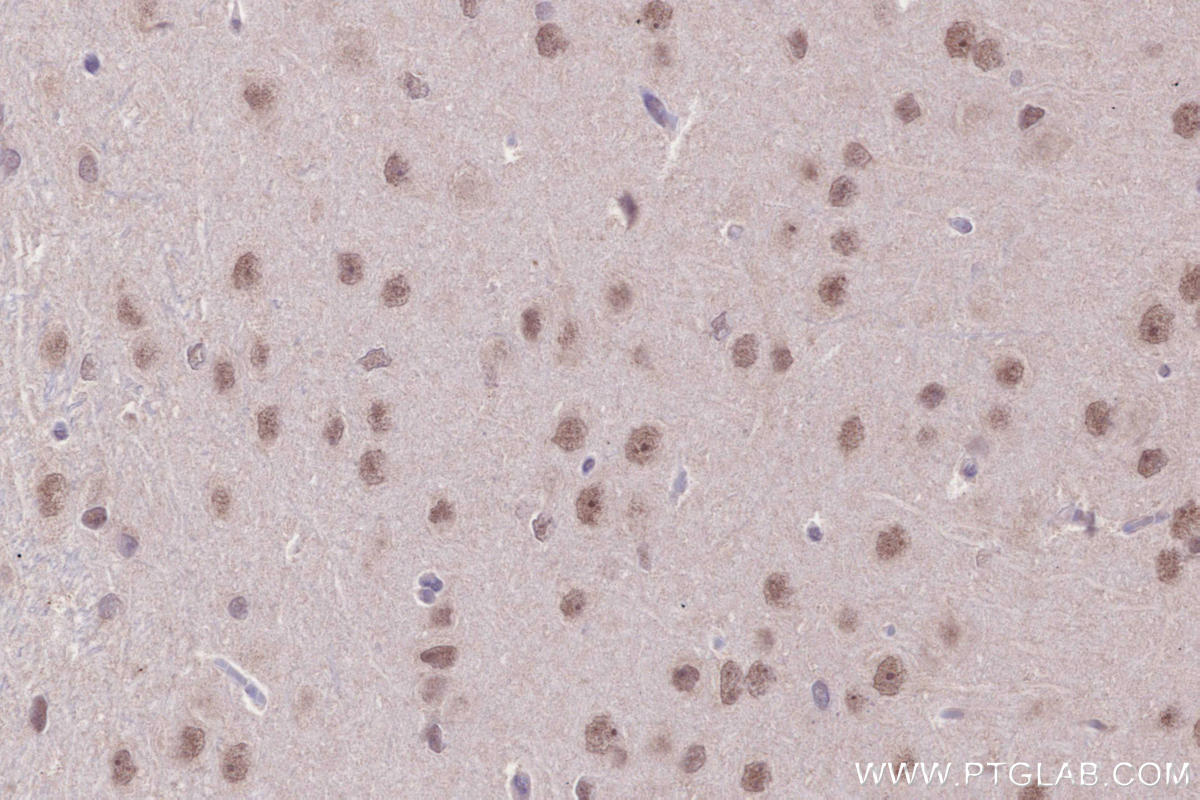 Immunohistochemical analysis of paraffin-embedded rat brain tissue slide using KHC2653 (PHF6 IHC Kit).
