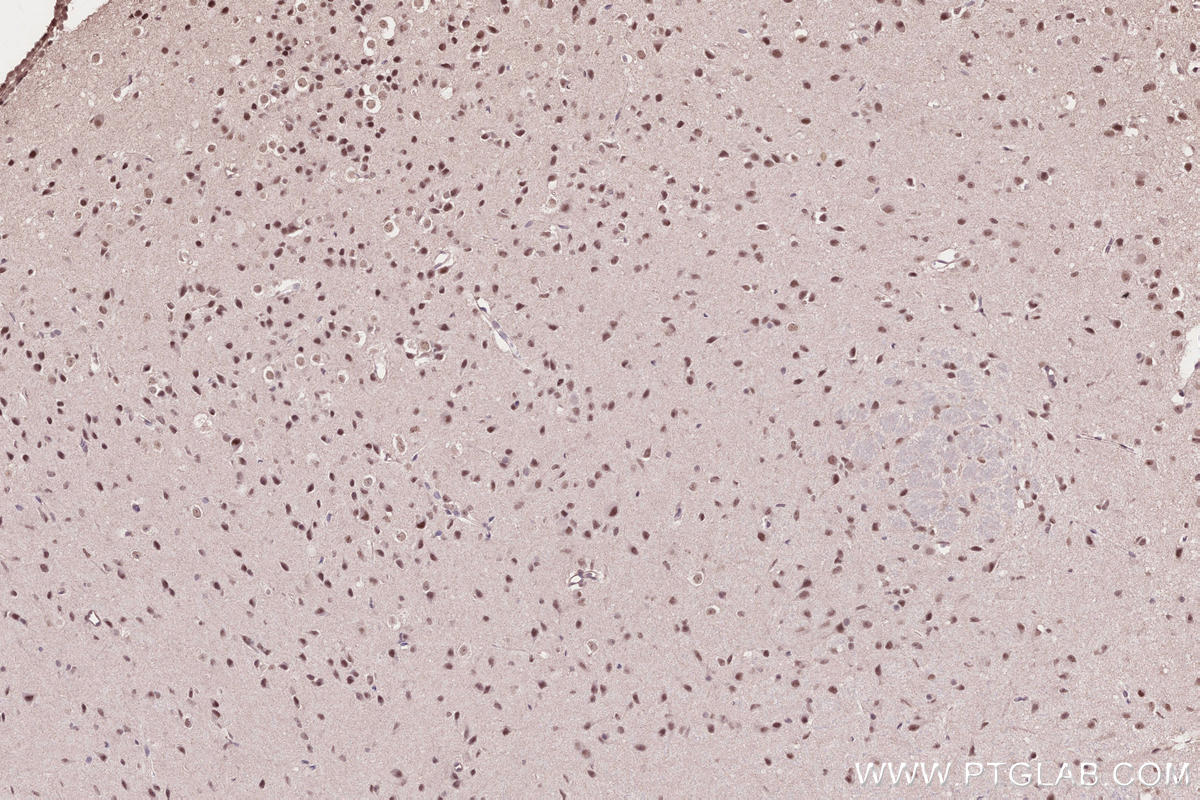 Immunohistochemical analysis of paraffin-embedded mouse brain tissue slide using KHC2653 (PHF6 IHC Kit).