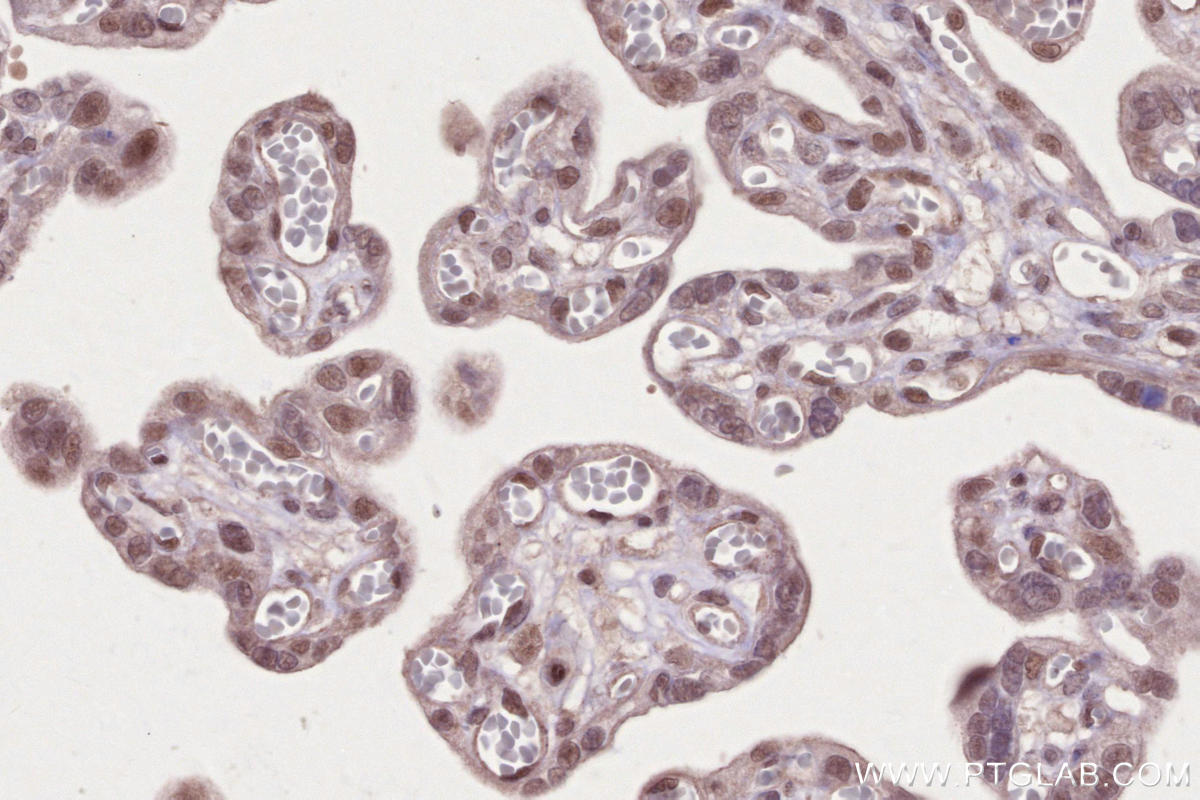 Immunohistochemical analysis of paraffin-embedded human placenta tissue slide using KHC2653 (PHF6 IHC Kit).