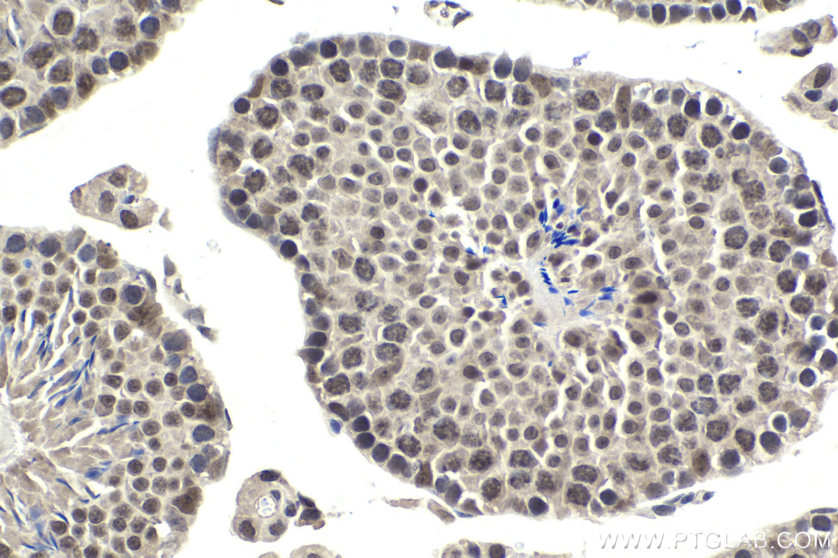 Immunohistochemical analysis of paraffin-embedded mouse testis tissue slide using KHC2008 (PHF8 IHC Kit).