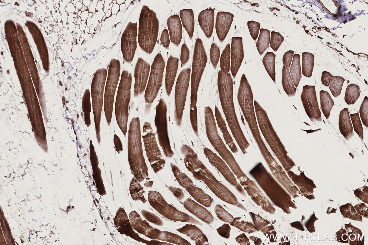 Immunohistochemical analysis of paraffin-embedded mouse skeletal muscle tissue slide using KHC2772 (PHKB IHC Kit).