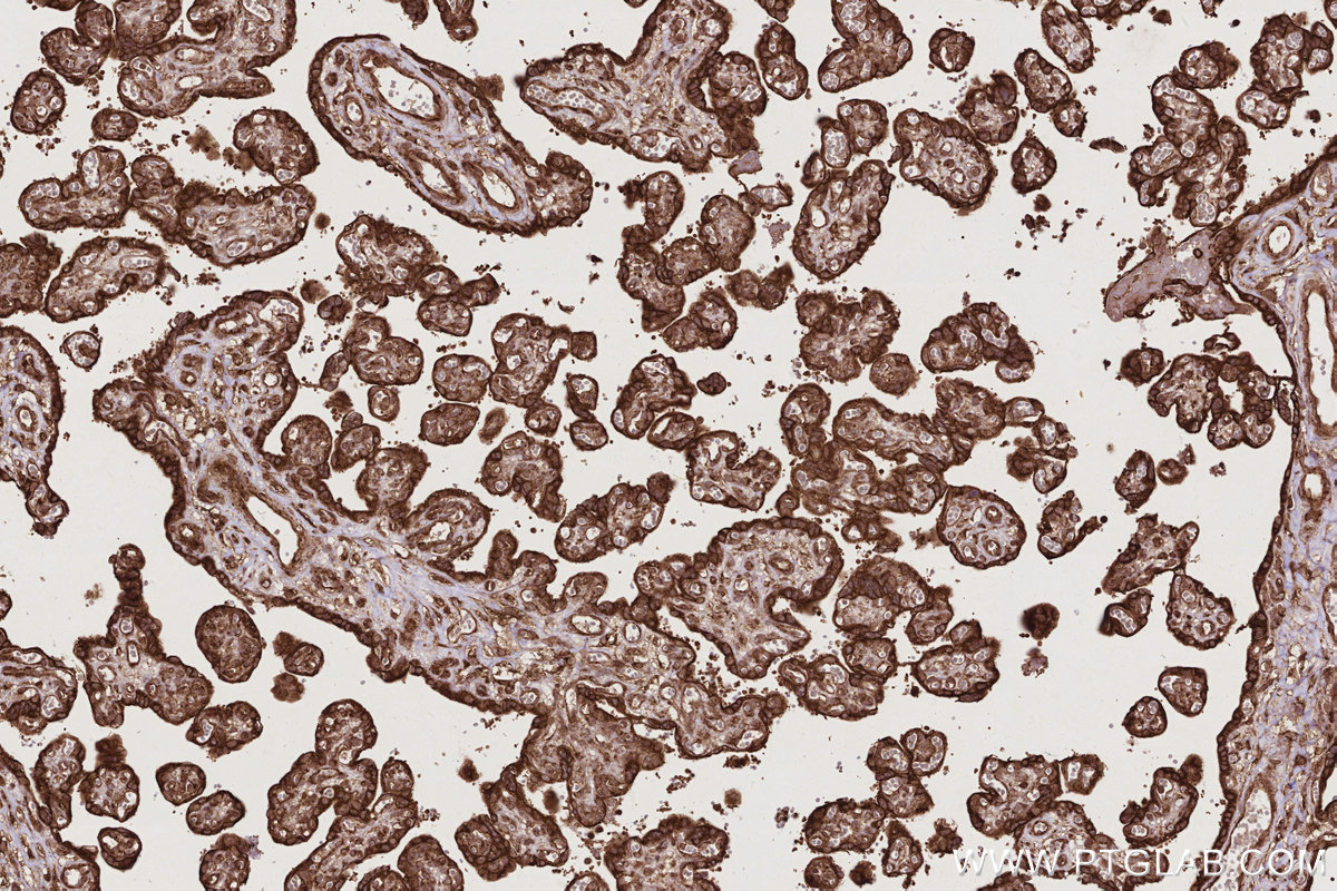 Immunohistochemical analysis of paraffin-embedded human placenta tissue slide using KHC2772 (PHKB IHC Kit).