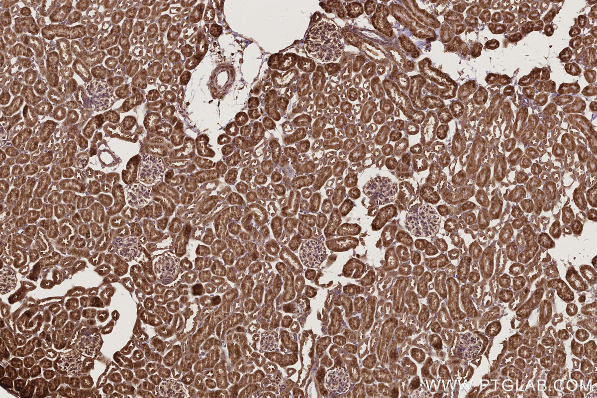 Immunohistochemical analysis of paraffin-embedded mouse kidney tissue slide using KHC2772 (PHKB IHC Kit).