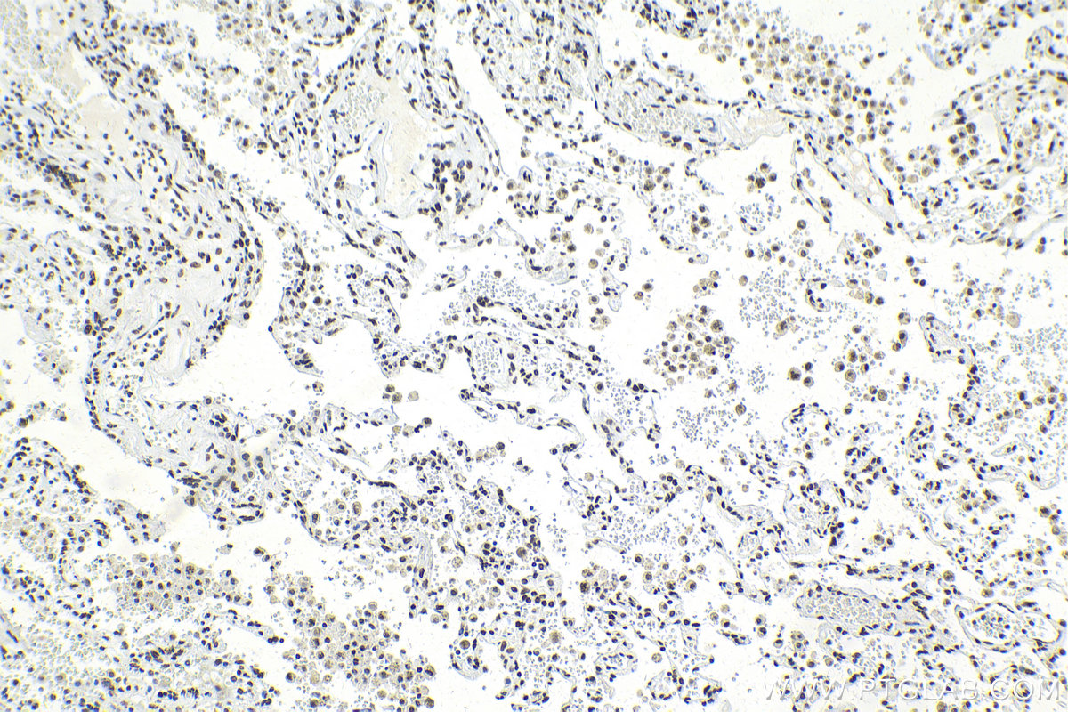 Immunohistochemical analysis of paraffin-embedded human lung tissue slide using KHC2122 (PIAS1 IHC Kit).