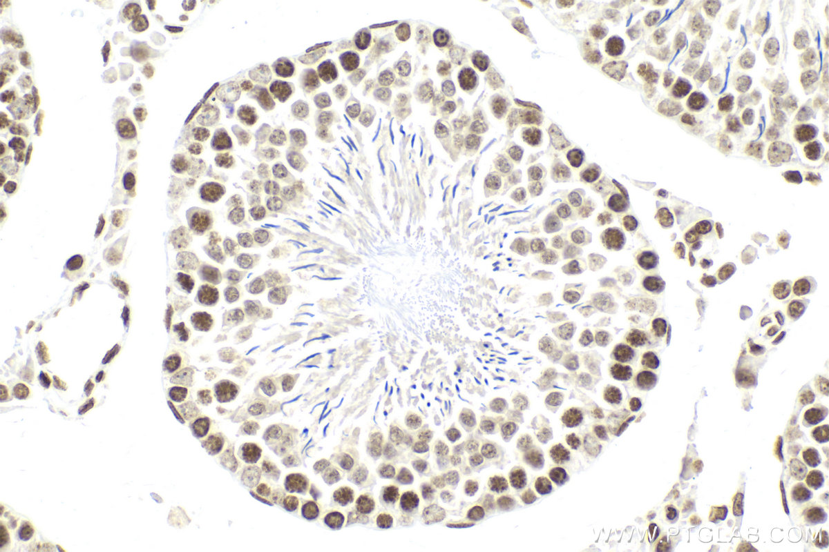 Immunohistochemical analysis of paraffin-embedded rat testis tissue slide using KHC2122 (PIAS1 IHC Kit).