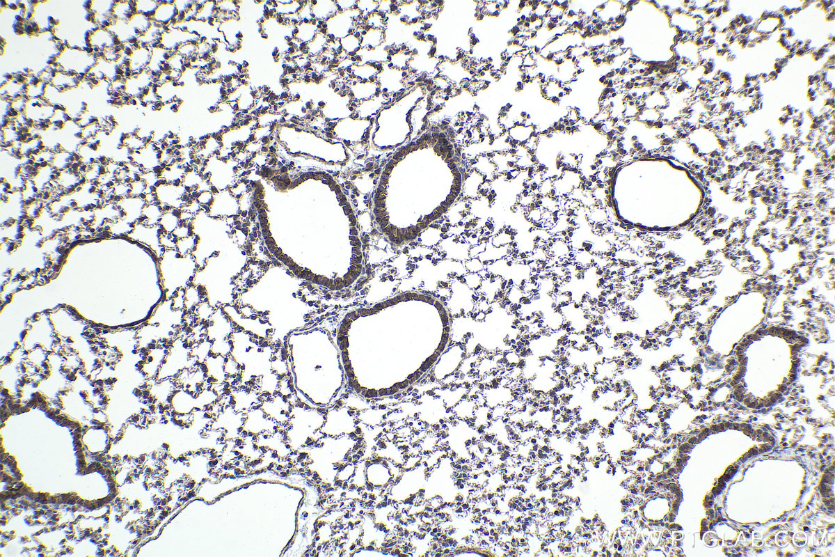 Immunohistochemical analysis of paraffin-embedded mouse lung tissue slide using KHC1943 (PIDD1 IHC Kit).