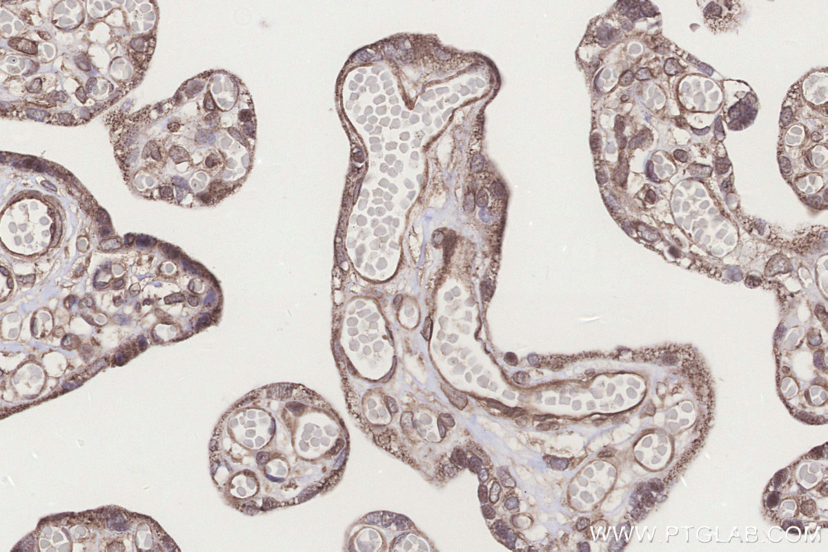Immunohistochemical analysis of paraffin-embedded human placenta tissue slide using KHC3234 (PIGP IHC Kit).
