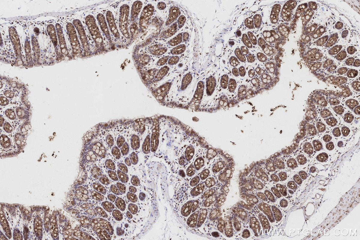 Immunohistochemical analysis of paraffin-embedded mouse colon tissue slide using KHC3161 (PIGR IHC Kit).