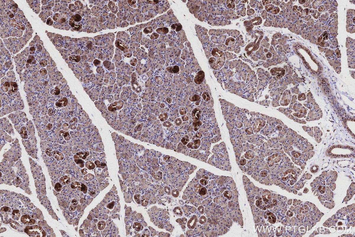 Immunohistochemical analysis of paraffin-embedded rat salivary gland tissue slide using KHC3161 (PIGR IHC Kit).