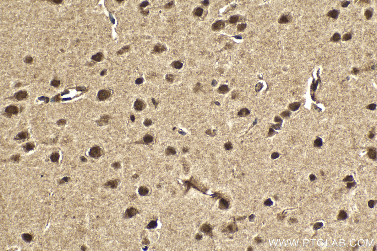Immunohistochemical analysis of paraffin-embedded mouse brain tissue slide using KHC2044 (PIK3C2A IHC Kit).