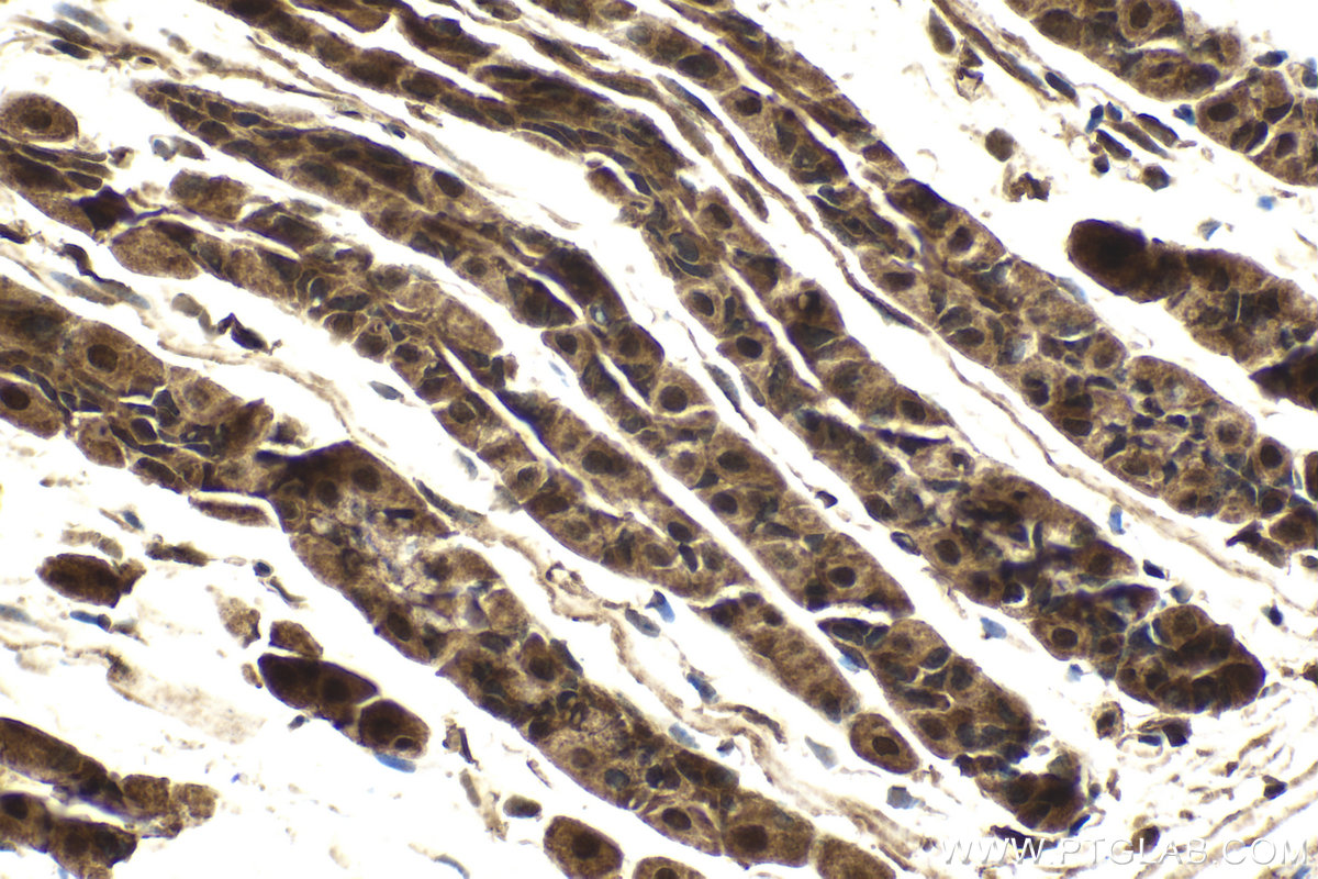 Immunohistochemical analysis of paraffin-embedded mouse stomach tissue slide using KHC2044 (PIK3C2A IHC Kit).