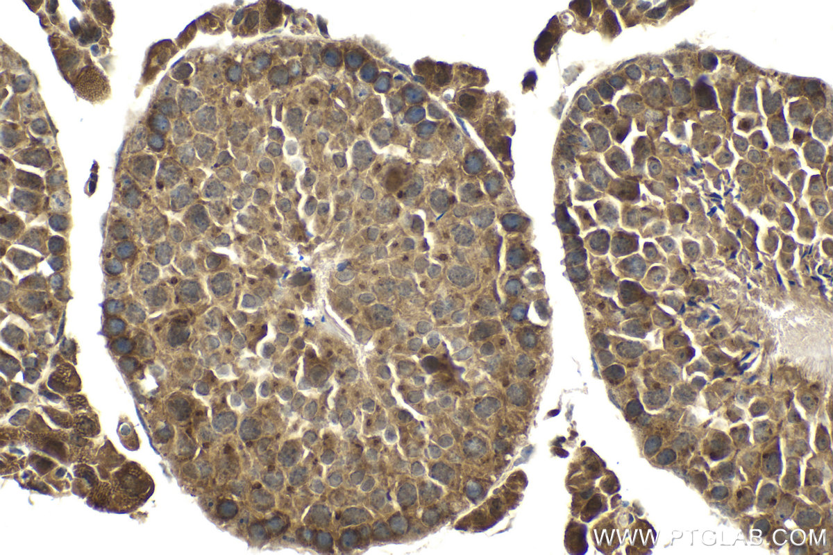 Immunohistochemical analysis of paraffin-embedded mouse testis tissue slide using KHC2044 (PIK3C2A IHC Kit).