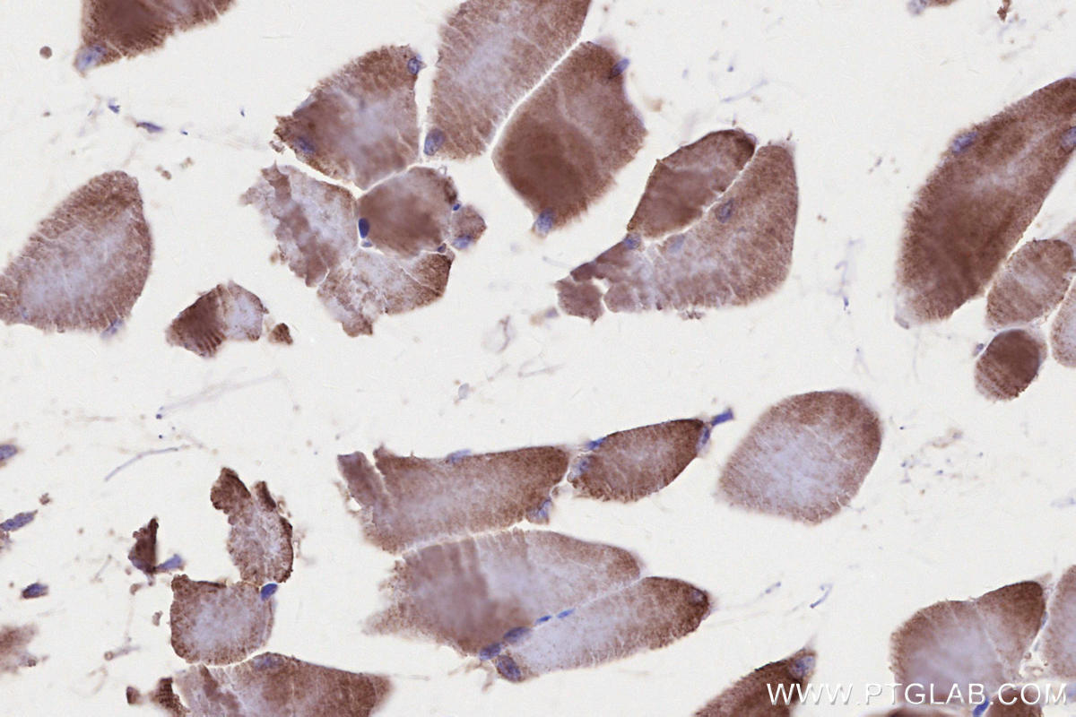 Immunohistochemical analysis of paraffin-embedded mouse skeletal muscle tissue slide using KHC2691 (PIK3C3/VPS34 IHC Kit).